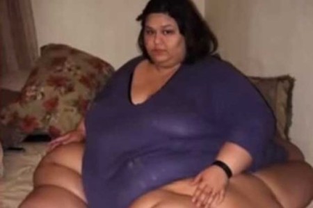 Obesitas vrouw